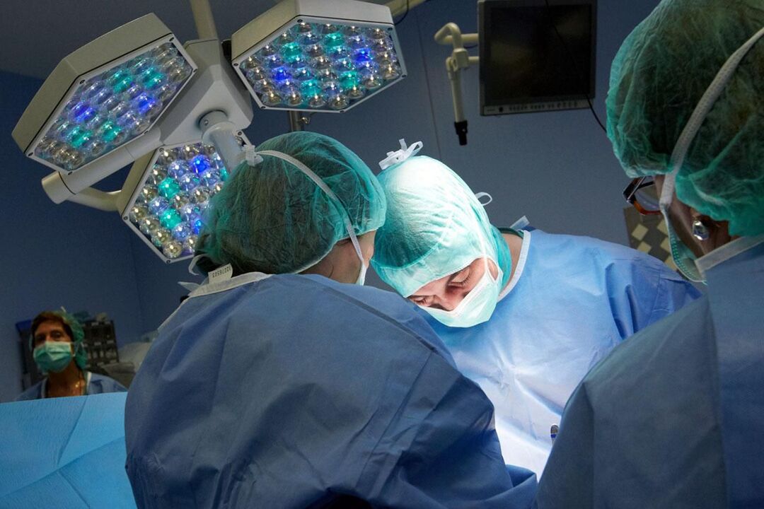 Delovanje pri kroničnem prostatitisu