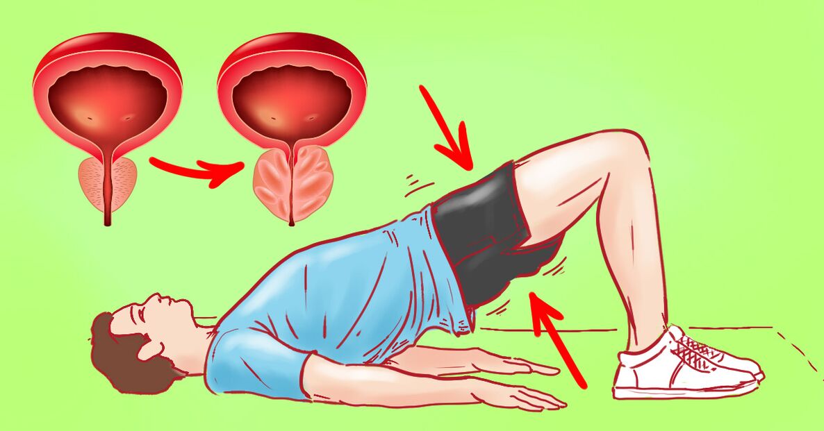 Terapevtske vaje za kronični prostatitis