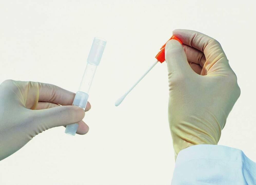 Zbirka analize za odkrivanje kroničnega prostatitisa