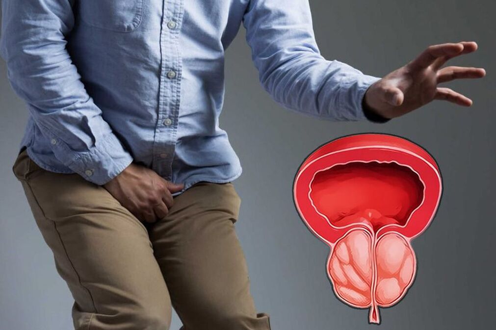 akutna prostata pri moških